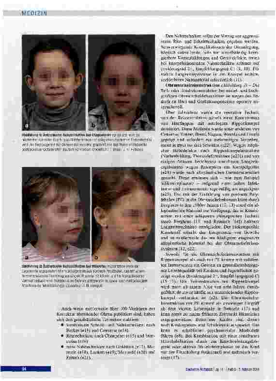 Vorschauseite 3: Entwicklungsstörungen des Ohres bei Kindern und Jugendlichen