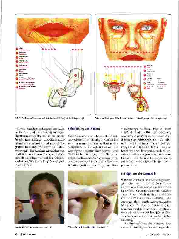 Vorschauseite 4: Monoluxtherapie Erfahrungen an Gesichtsarealen, Narben und Reflexzonen