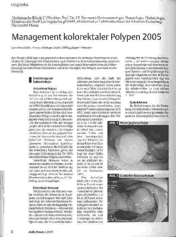 Vorschauseite 1: Management kolorektaler Polypen 2005