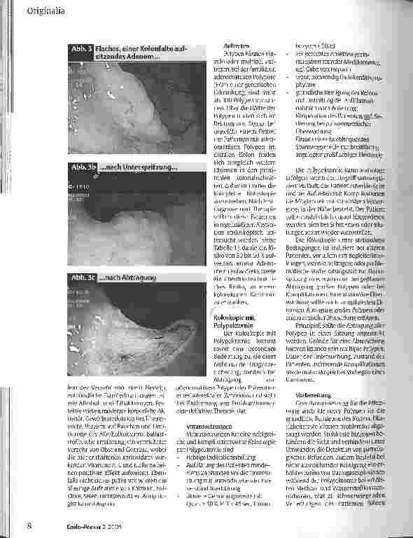 Vorschauseite 2: Management kolorektaler Polypen 2005