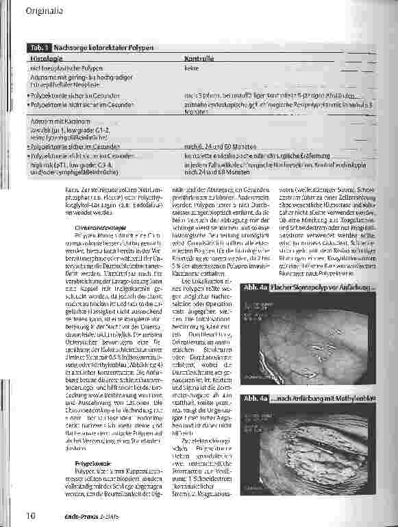 Vorschauseite 3: Management kolorektaler Polypen 2005