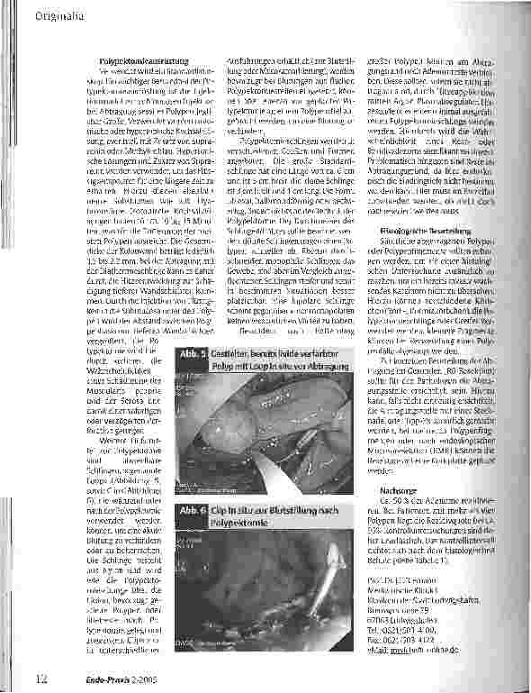 Vorschauseite 4: Management kolorektaler Polypen 2005