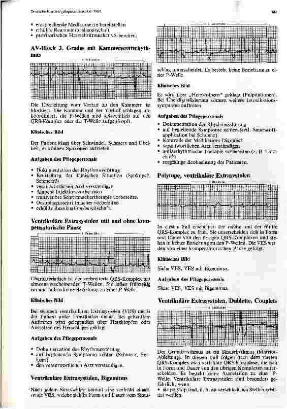 Vorschauseite 4: Die für das Pflegepersonal auf Intensivstationen relevanten Herzrhythmusstörungen