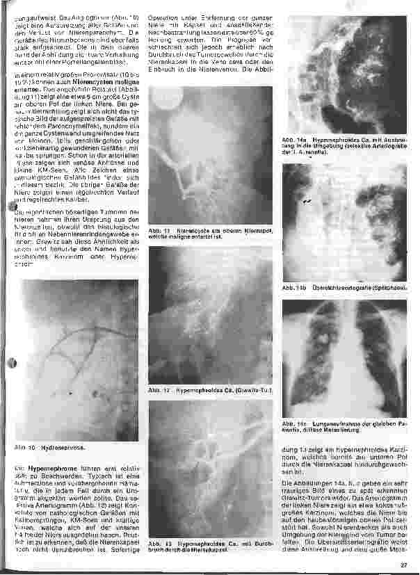 Vorschauseite 4: Radiologie 25. Folge: Röntgenuntersuchung des Abdomens (II.)