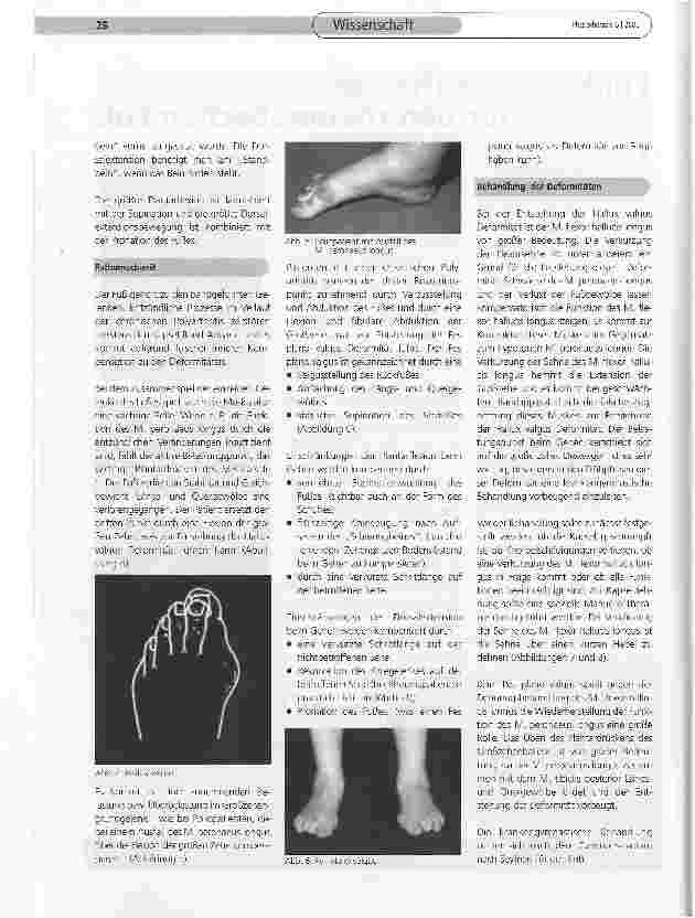 Vorschauseite 2: Funktionelle Therapie für den rheumatischen Fuß