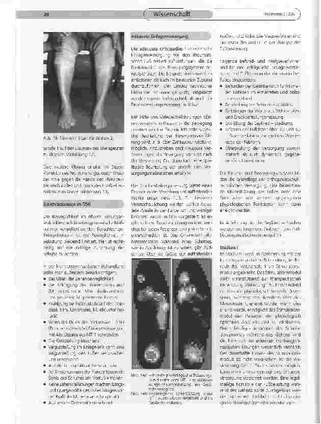 Vorschauseite 4: Funktionelle Therapie für den rheumatischen Fuß
