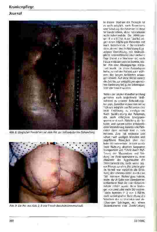 Vorschauseite 6: Fisteln des oberen Gastrointestinaltraktes, kombiniert mit einem Bauchwanddefekt Ein standardisiertes Therapiekonzept