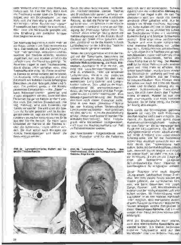 Vorschauseite 5: Einführung in die Hals-Nasen-Ohren-Heilkunde 20. Folge: Der Kehlkopf - Die Tumoren des Kehlkopfes