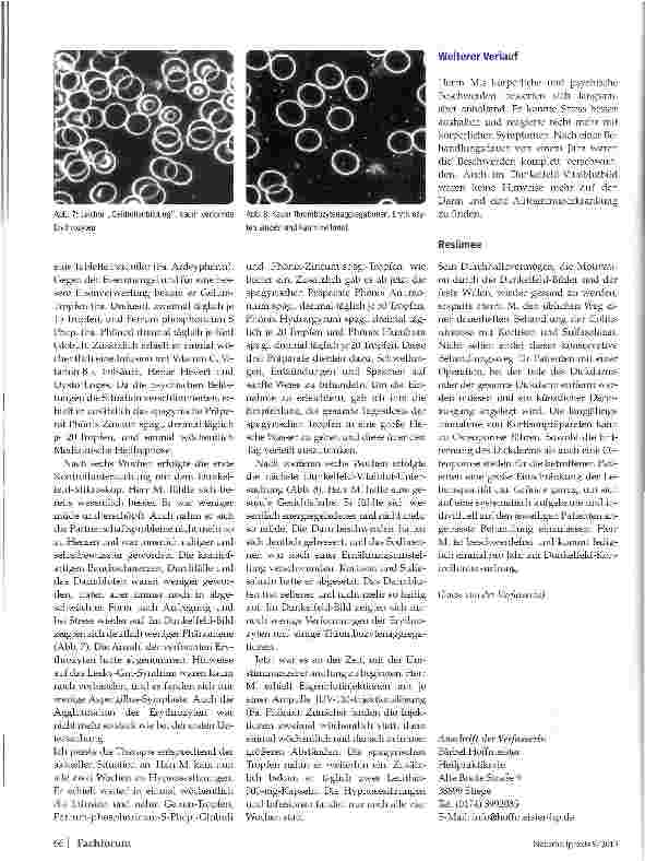 Vorschauseite 3: Praxisfall Colitis ulcerosa
