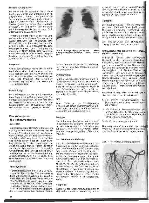 Vorschauseite 4: Das Herz 14.Folge: Die koronare Herzerkrankung, Klinik und operative Therapie