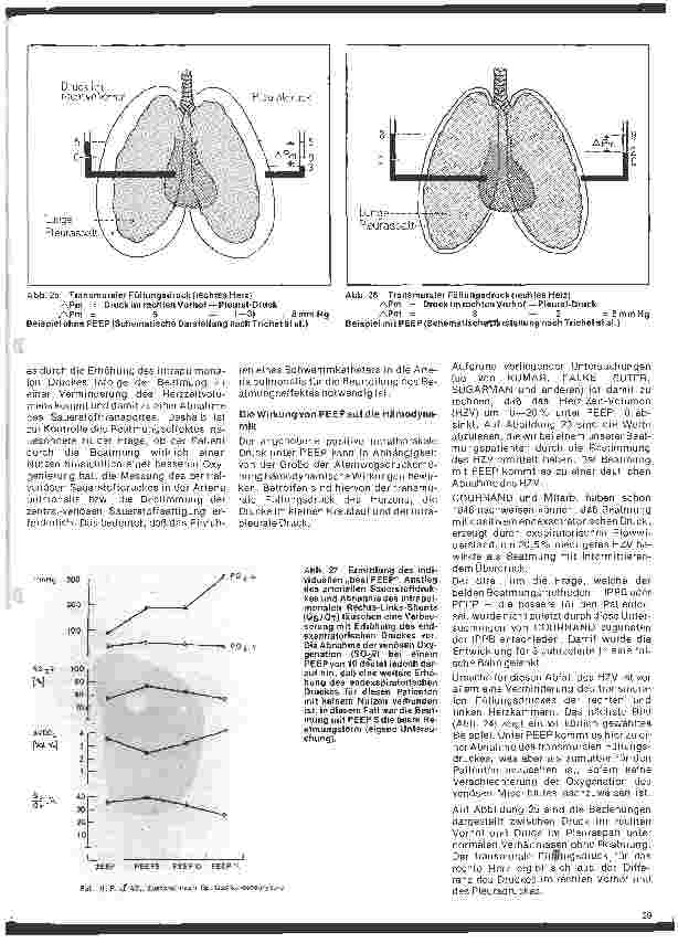 Vorschauseite 4: Aktuelle Themen aus Intensivmedizin und Anästhesiologie Die künstliche Beatmung (Fortsetzung)