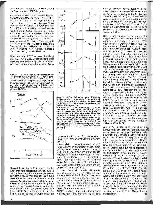 Vorschauseite 5: Aktuelle Themen aus Intensivmedizin und Anästhesiologie Die künstliche Beatmung (Fortsetzung)