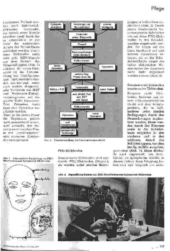 Vorschauseite 2: Epilepsie - Neurochirurgie 1. Teil: Medizinische Aspekte während des Intensivmonitorings