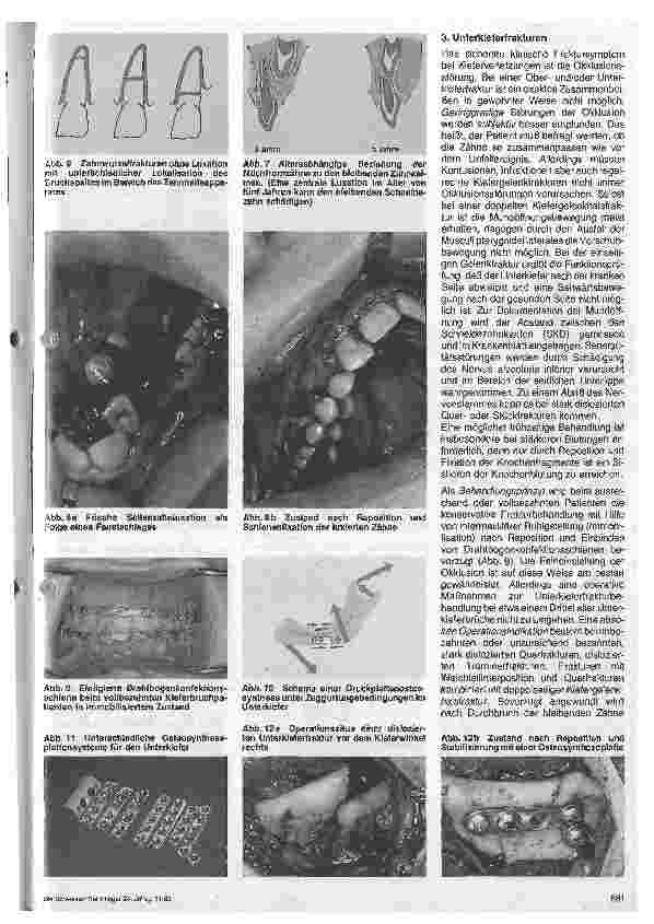 Vorschauseite 3: Kieferchirurgie und Plastische Gesichtschirurgie (5.Teil)
