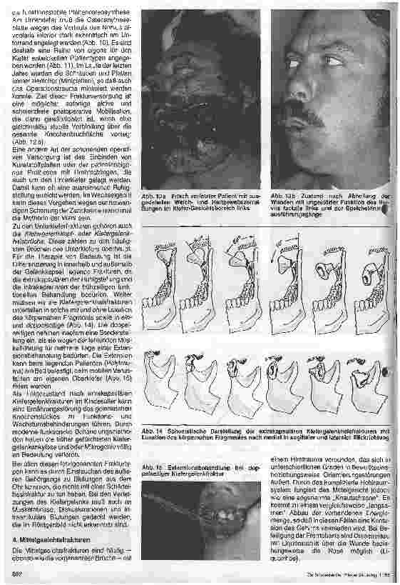 Vorschauseite 4: Kieferchirurgie und Plastische Gesichtschirurgie (5.Teil)