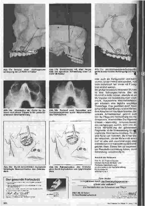 Vorschauseite 6: Kieferchirurgie und Plastische Gesichtschirurgie (5.Teil)