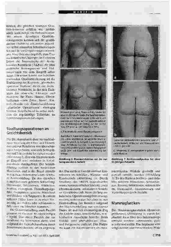 Vorschauseite 4: Ästhetische Chirurgie: Qualitätssicherung dringend erforderlich