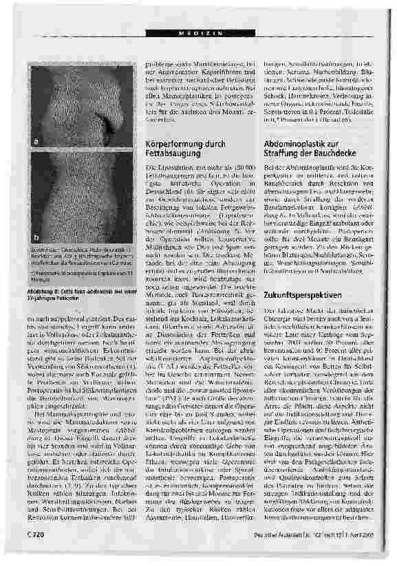 Vorschauseite 5: Ästhetische Chirurgie: Qualitätssicherung dringend erforderlich