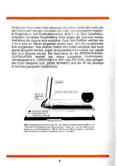 Vorschauseite 2: Die Argon-Plasma-Coagulation
