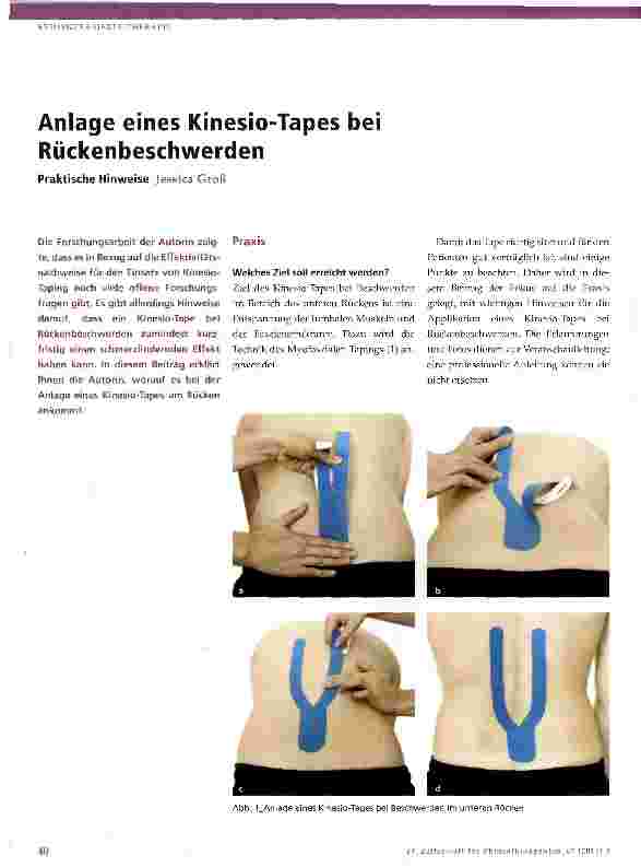 Vorschauseite 1: Anlage eines Kinesio-Tapes bei Rückenbeschwerden