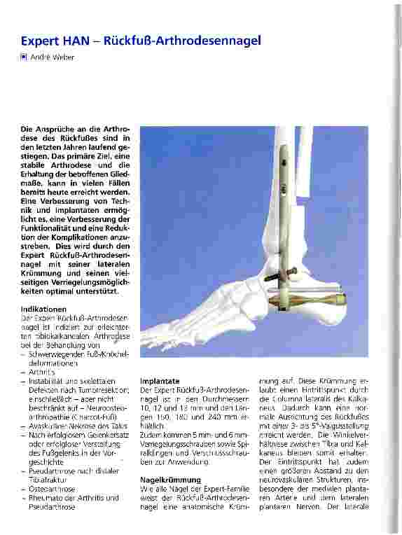 Vorschauseite 1: Expert HAN - Rückfuß-Arthrodesennagel