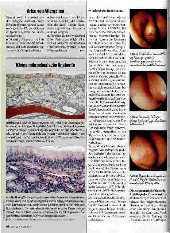Vorschauseite 3: Allergische Reationen der Nase Diagnostik und Therapie