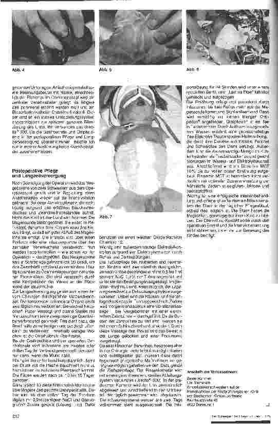 Vorschauseite 2: Die vordere Bauchspalte - aus pflegerischer Sicht