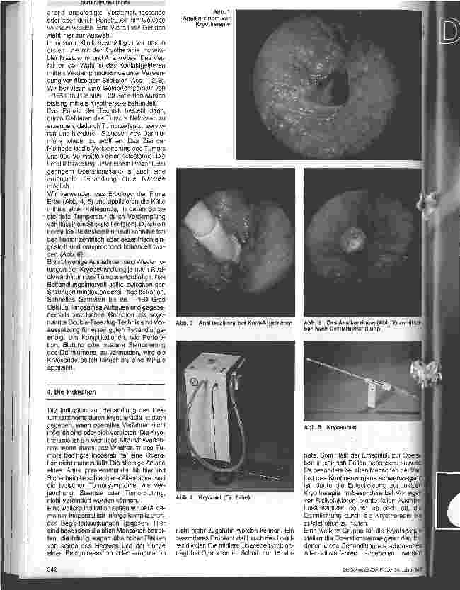 Vorschauseite 2: Anwendung der Kryotherapie in der Chirurgie/Unter besonderer Berücksichtigung des Mastdarmkrebses