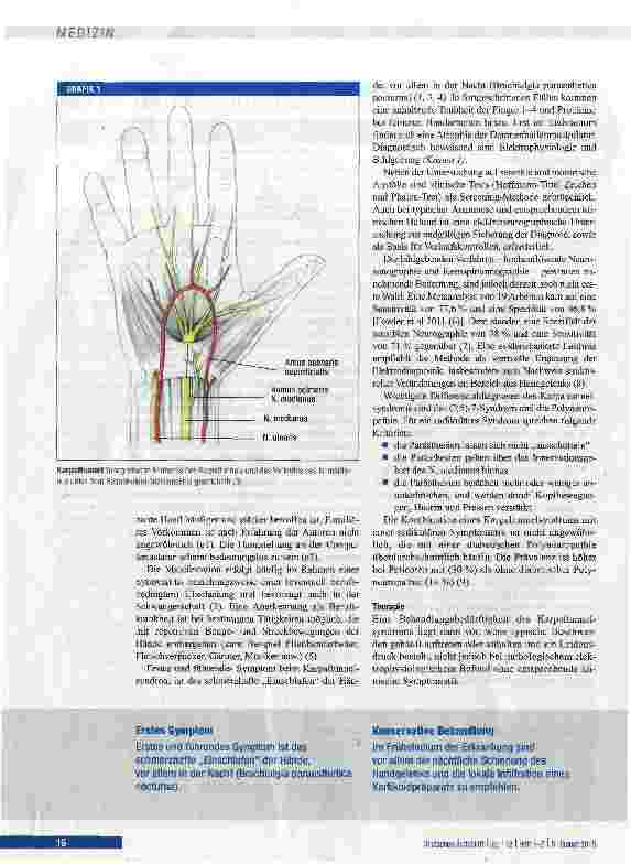 Vorschauseite 3: Karpaltunnel-, Kubitaltunnelund seltene Nervenkompressionssyndrome