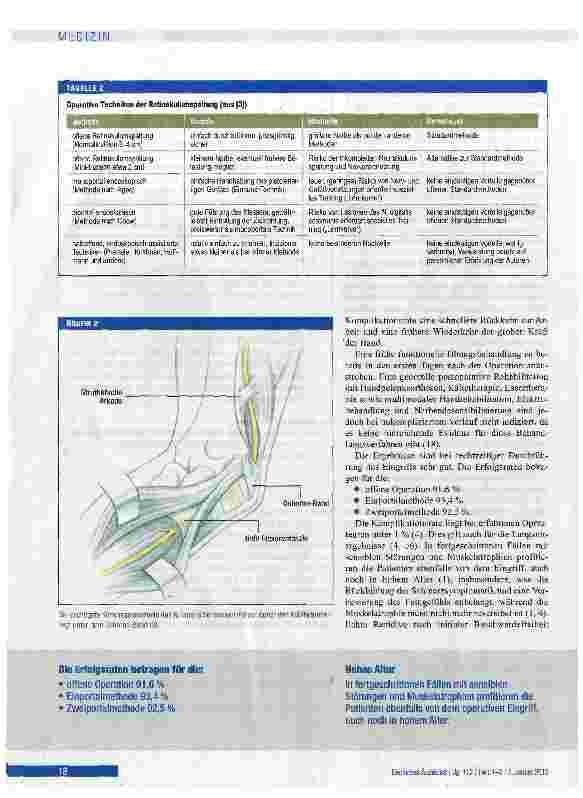 Vorschauseite 5: Karpaltunnel-, Kubitaltunnelund seltene Nervenkompressionssyndrome