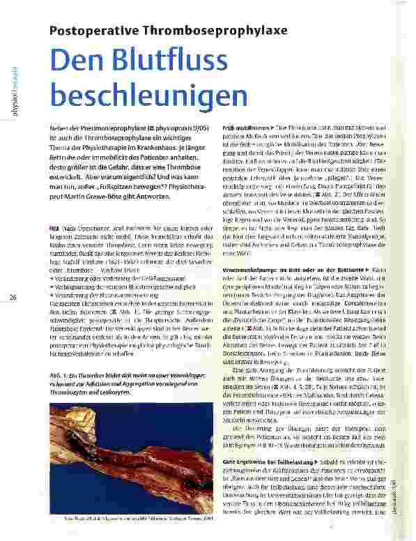 Vorschauseite 1: Postoperative Thromboseprophylaxe Den Blutfluss beschleunigen