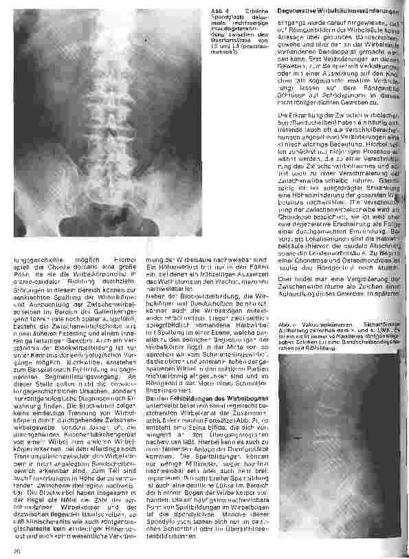 Vorschauseite 3: Radiologie Eine Einführung für Krankenschwestern und Krankenpfleger 29. Folge: Röntgenuntersuchungen der Wirbelsäule