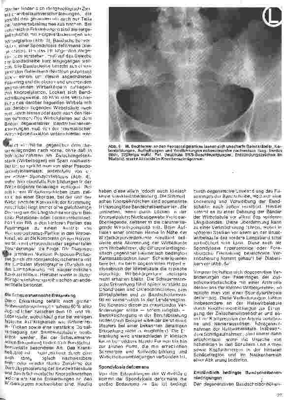 Vorschauseite 4: Radiologie Eine Einführung für Krankenschwestern und Krankenpfleger 29. Folge: Röntgenuntersuchungen der Wirbelsäule