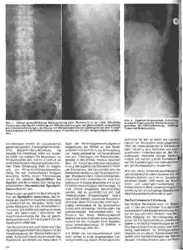 Vorschauseite 5: Radiologie Eine Einführung für Krankenschwestern und Krankenpfleger 29. Folge: Röntgenuntersuchungen der Wirbelsäule