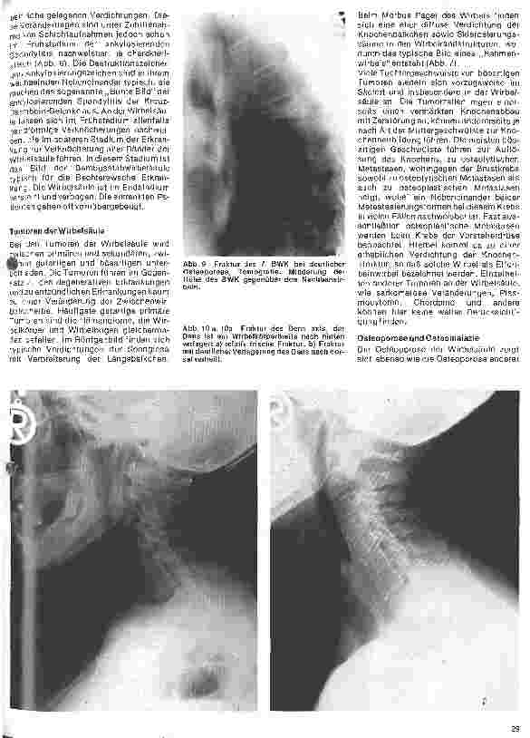 Vorschauseite 6: Radiologie Eine Einführung für Krankenschwestern und Krankenpfleger 29. Folge: Röntgenuntersuchungen der Wirbelsäule