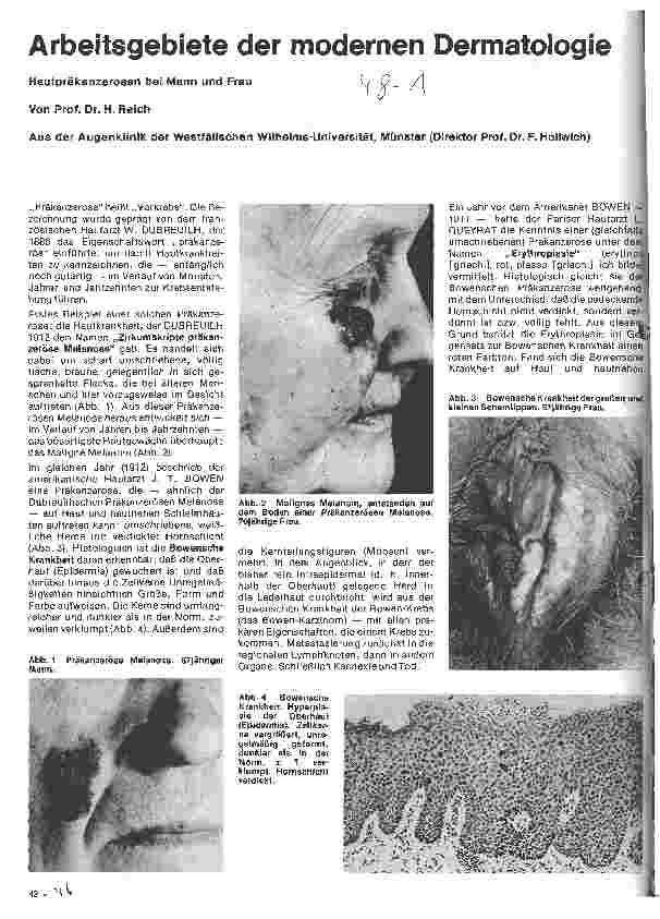 Vorschauseite 1: Arbeitsgebiete der modernen Dermatologie Hautpräkanzerosen bei Mann und Frau