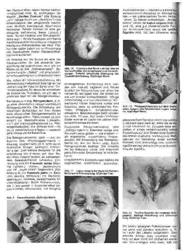 Vorschauseite 3: Arbeitsgebiete der modernen Dermatologie Hautpräkanzerosen bei Mann und Frau