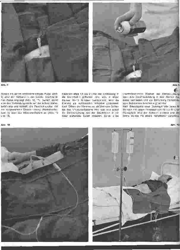 Vorschauseite 3: Peritonealdialyse