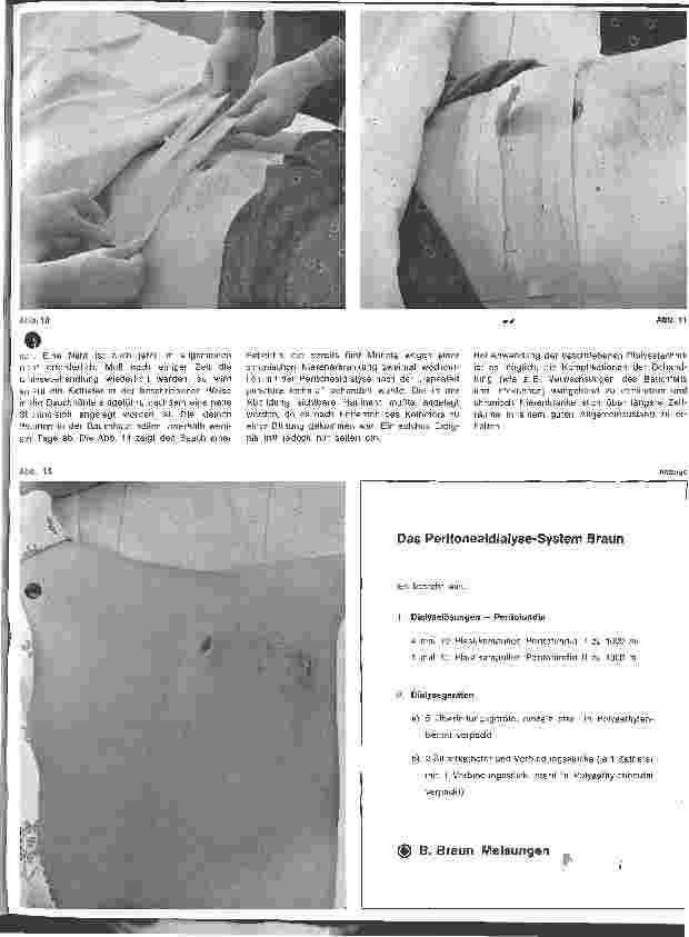 Vorschauseite 4: Peritonealdialyse