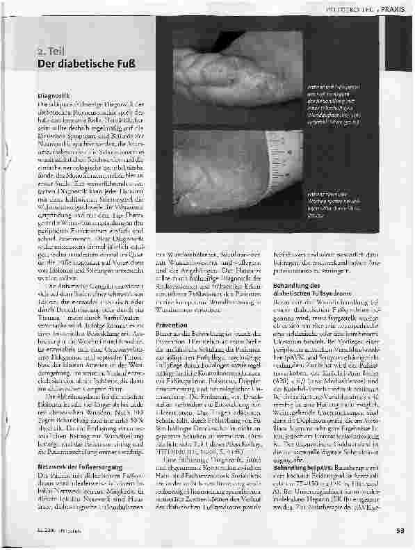 Vorschauseite 2: Wunden mit hohem Infektionsrisiko - 2. Teil Der diabetische Fuß