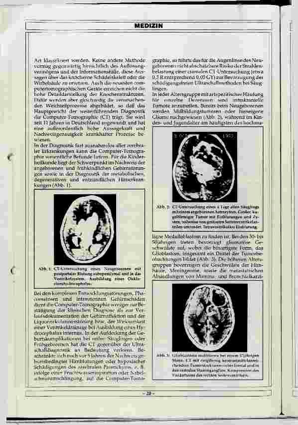 Vorschauseite 2: Aufgaben der Neuroradiologie
