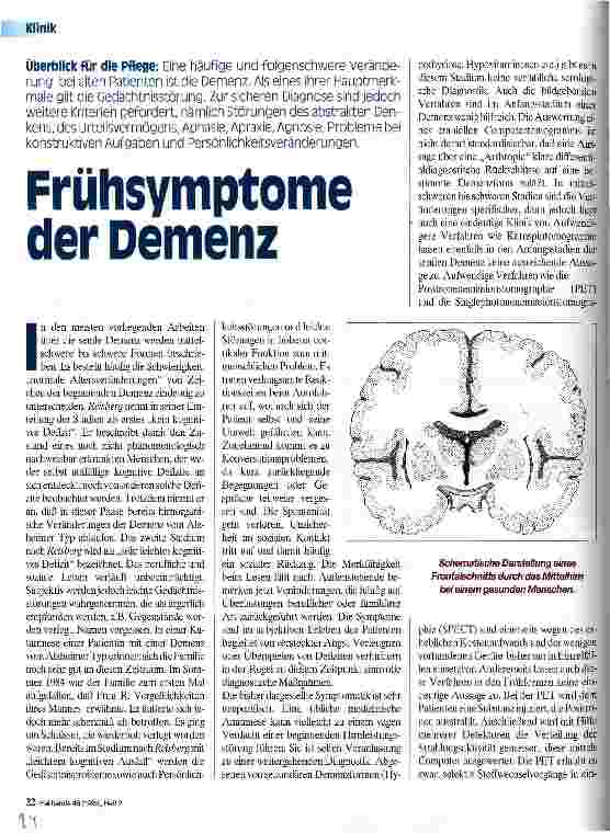 Vorschauseite 1: Frühsymptome der Demenz Überblick für die Pflege