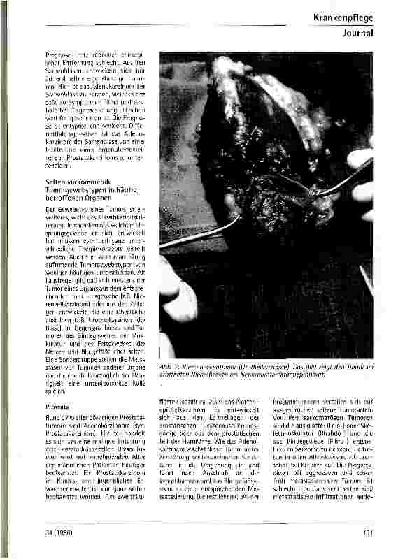 Vorschauseite 4: Seltene urologische Tumoren