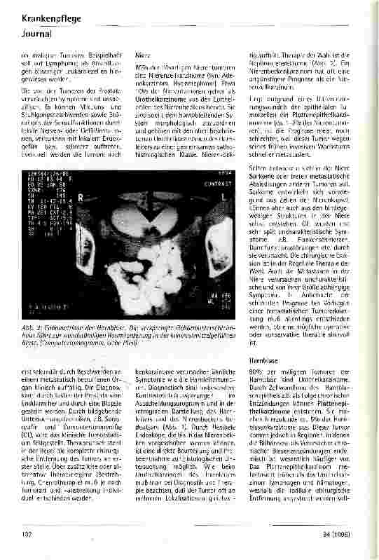 Vorschauseite 5: Seltene urologische Tumoren
