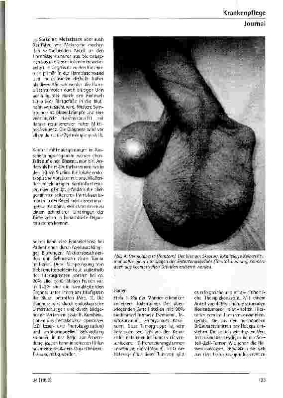 Vorschauseite 6: Seltene urologische Tumoren