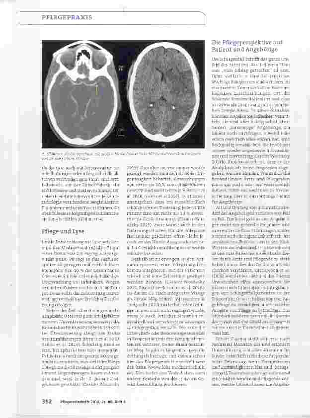 Vorschauseite 3: Update Schlaganfall Neues zur Pflege auf der Stroke Unit