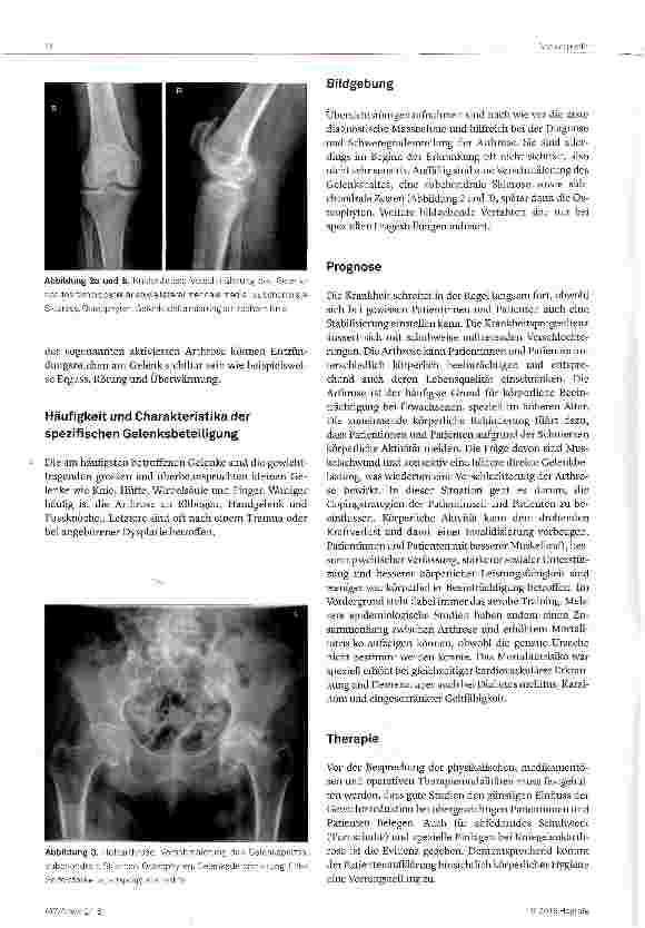 Vorschauseite 2: Arthrose - eine Übersicht