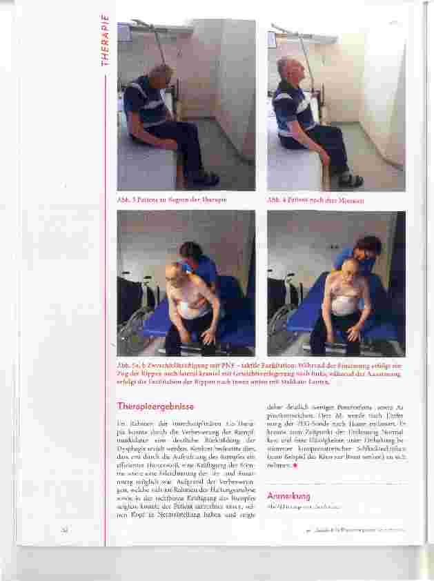 Vorschauseite 3: Interdisziplinäre Rehabilitation bei Dysphagie