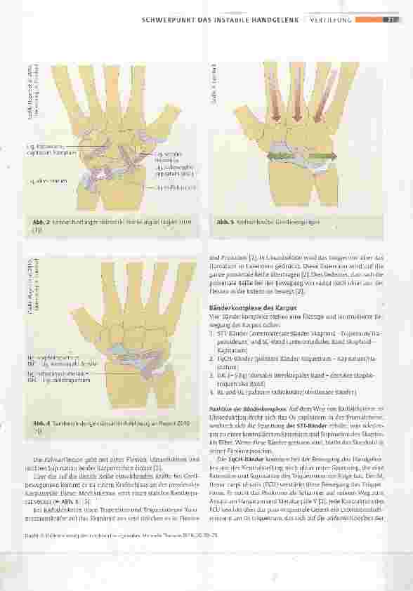 Vorschauseite 2: Differenzierung des instabilen Handgelenkes