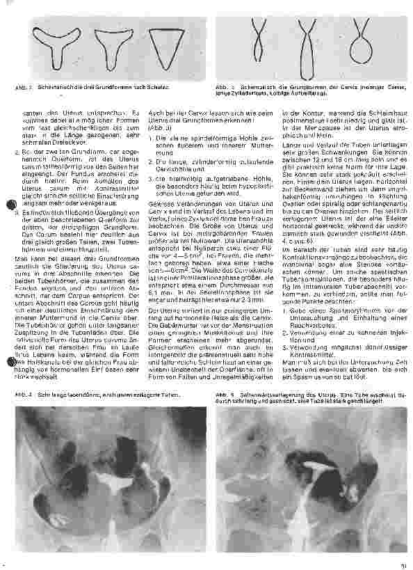 Vorschauseite 2: Radiologie Eine Einführung für Krankenschwestern u.Krankenpfleger 28. Folge:Röntgenologische Untersuchungen der weiblichen Genitalorgane